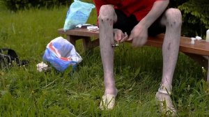 Саморезик. Удаление занозы.