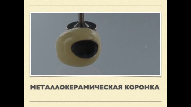 Оттиск с абатмента смотреть онлайн