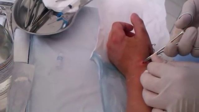 Спицы вынуть