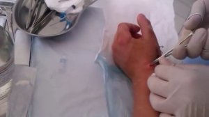 Спицы вынуть