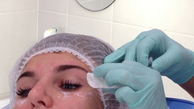 Ботулинотерапия Верхняя и средняя часть лица Меди Лайт смотреть онлайн