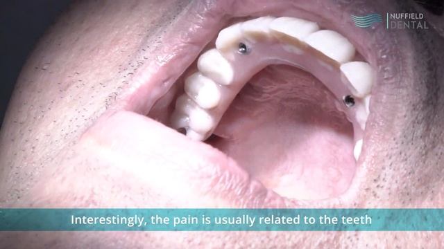 Is All-On-4 painful? with Dr Samintharaj Kumar смотреть онлайн