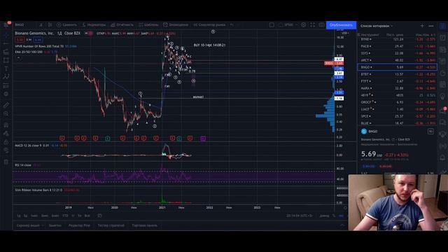 Акции Bionano Genomics, Inc. (BNGO) Пора покупать? смотреть онлайн