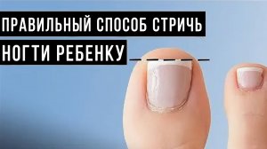 Как стричь ногти ребенку, чтобы не было вросших ногтей и заусенец