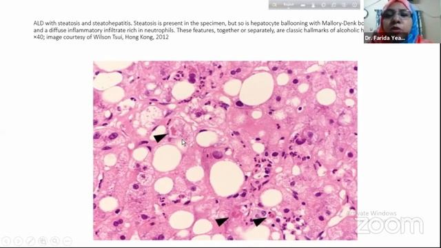 GIT (Histology & Histopathology) | Class-7 | Liver Pathology (part-3) смотреть онлайн