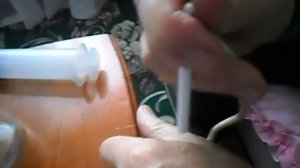 Удаление угрей вакуумом.Вакуумный бокс.