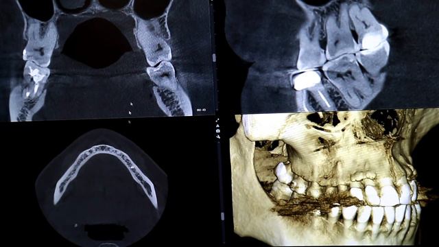 Томограф Planmeca ProMax 3D Plus смотреть онлайн