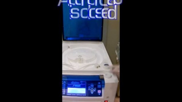 DetroWASH Fully Automated Endoscope Washer & Disinfector Machine
