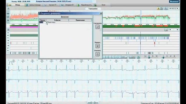 Общие настройки анализа по методике Холтер ЭКГ.WMV смотреть онлайн