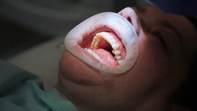 Зубное протезирование. Стоматология ПрезиДЕНТ Отрадное смотреть онлайн