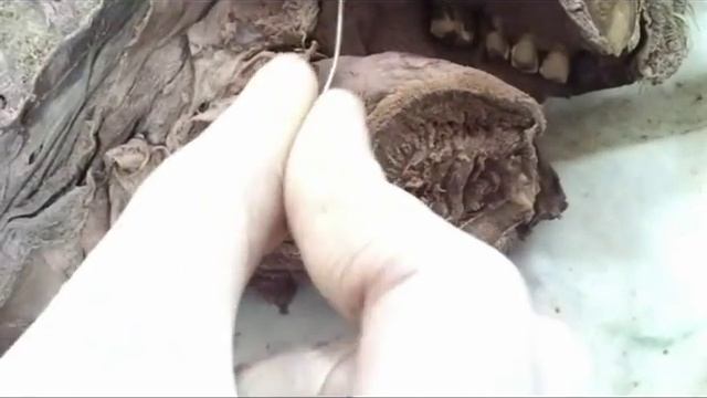 Anatomy of head & neck of GIT by ASM смотреть онлайн