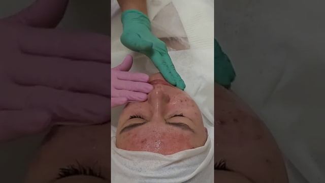 АирисКом студенты учатся: семинар для студентов. ТСА пилинг. смотреть онлайн