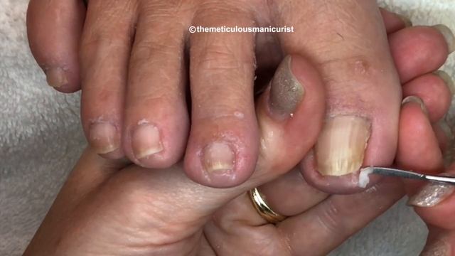 ? Beginners How to Clean Toenails at Home Pedicure Tutorial ? смотреть онлайн