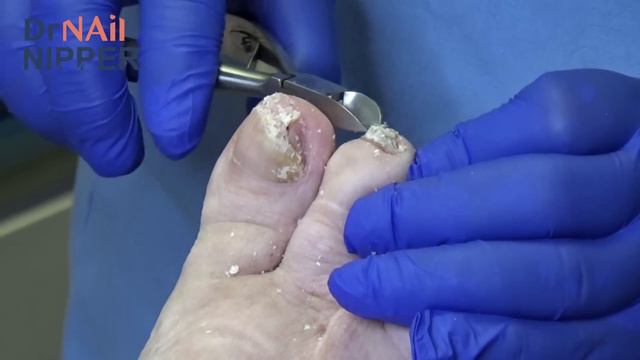 Toenails Cut a Year Ago (2020) смотреть онлайн