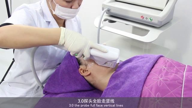 HIFU SMAS лифтинг, ультразвуковая подтяжка лица смотреть онлайн