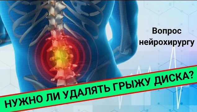ГРЫЖА. Нужно ли удалять? смотреть онлайн