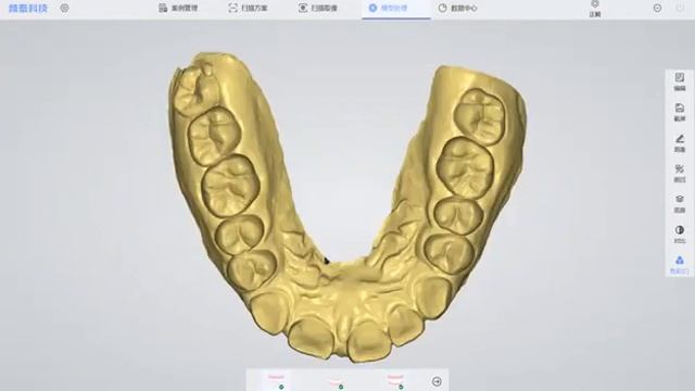 Panda Scanner | Orthodontics - 3 смотреть онлайн