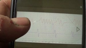 NISSAN MAXIMA не заводится.