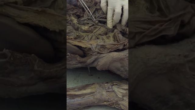 Грудные и брюшные ветви аорты