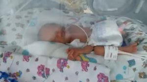 Ребенок родился на 3 месяца раньше. Недоношенный малыш 26 недель 950гр. В кювезе