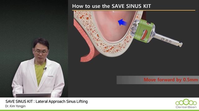 [#Dentalbean] Save Sinus Kit (Lateral Part) смотреть онлайн