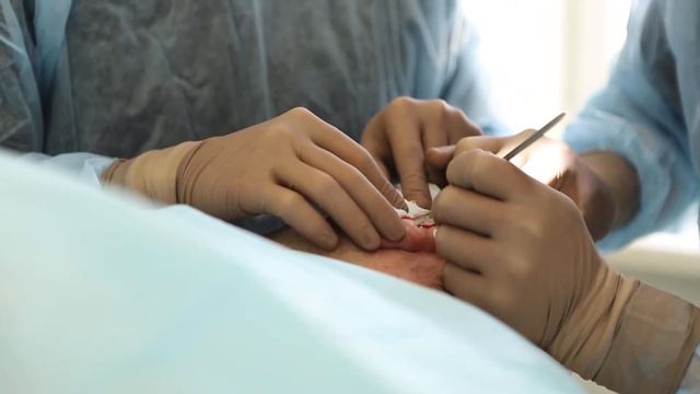 Отопластика. Хирург - Гуляев А.В. Часть 1. смотреть онлайн