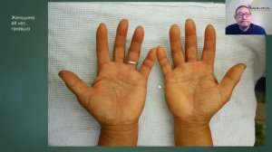 Практический курс по ведической хиромантии. Урок 3.