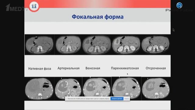 Петрушин А.В. "Опыт локального контроля" смотреть онлайн