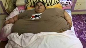 Самые толстые люди.  ТОП 10.  Самое интересное.