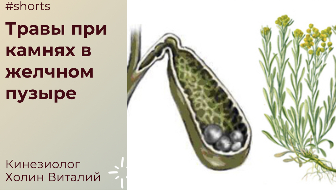 Травы при камнях в желчном пузыре смотреть онлайн