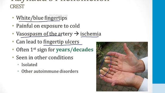 Immunology - 4. Autoimmune Disorders - 3.Scleroderma atf смотреть онлайн