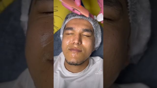 комплексная чистка лица. смотреть онлайн