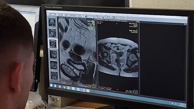 Как женщине подготовиться к МРТ малого таза, чтобы получить максимально надежный результат смотреть онлайн