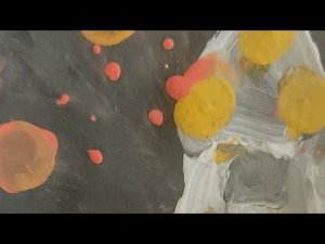 Кривошея: как лечить, что делать