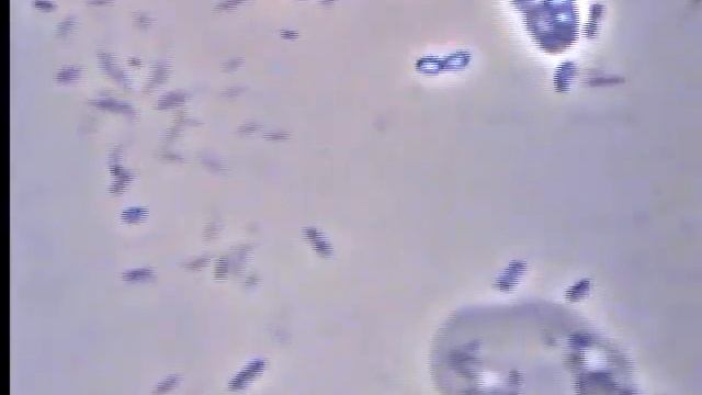 Микроорганизмы под микроскопом-водная среда | Microorganisms Under The Microscope-water Environment