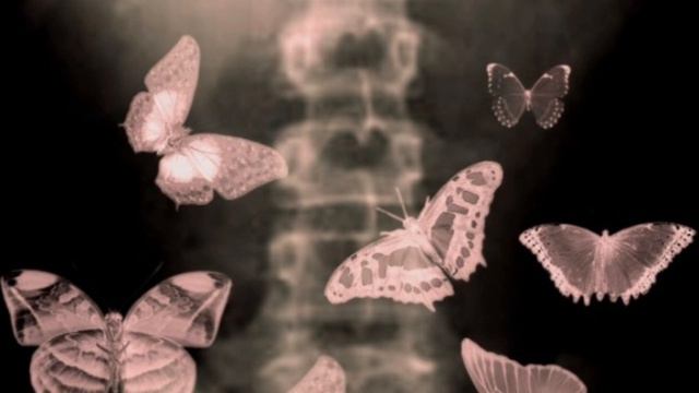 полный бабочек живот🩷 смотреть онлайн