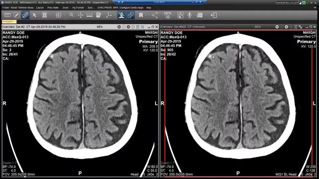 AI Based Decision Support with Universal Viewer смотреть онлайн