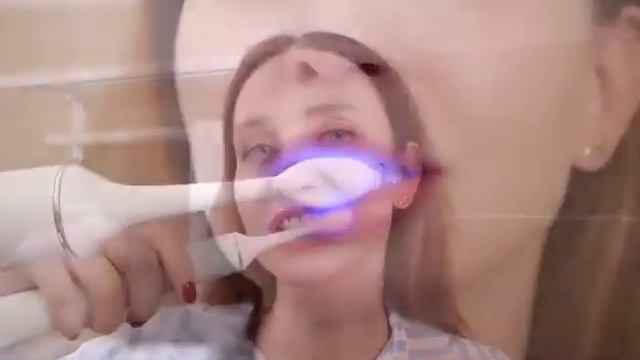 Электрическая зубная щетка для отбеливания IVISMILE