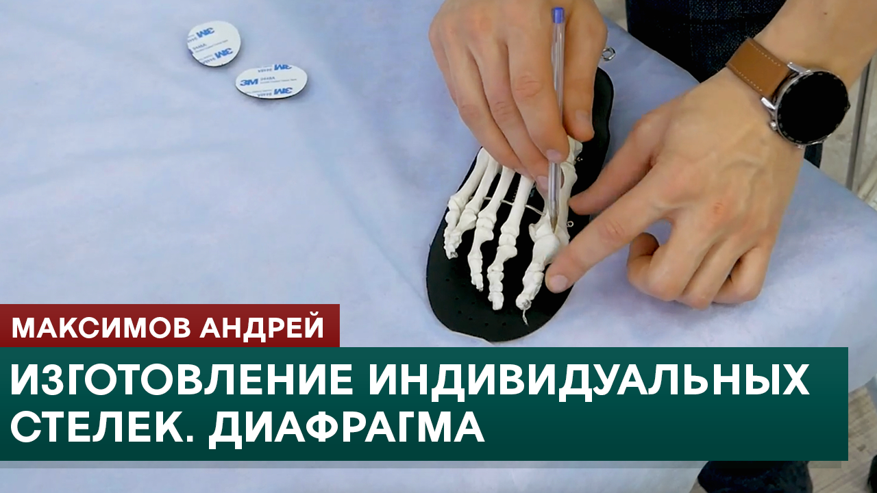 Изготовление индивидуальных стелек. Диафрагма. Максимов Андрей смотреть онлайн