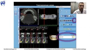Вебинар. 7 прикладных инструментов в анализе КТ для стоматолога. Александр Обрубов