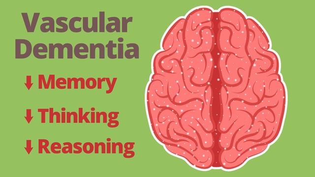 How Diabetes Can Affect Your Brain