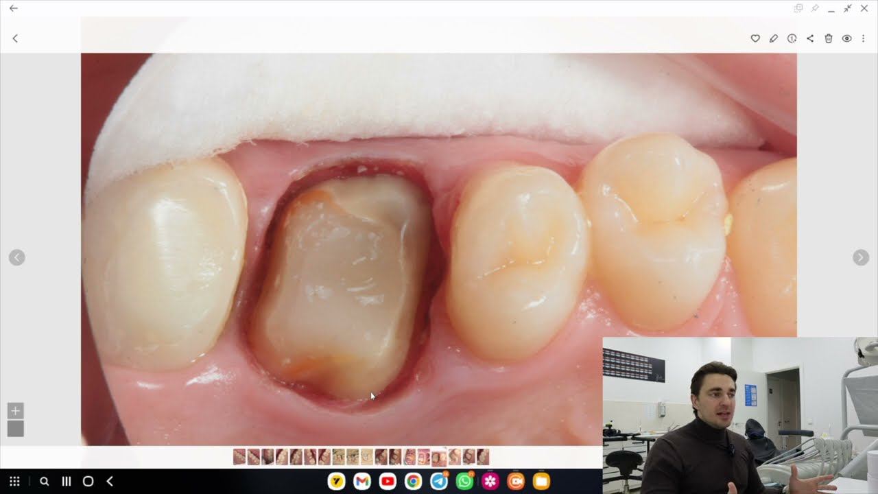 СТОМБУДНИ#31. Голые зубы, упругие десна без регистрации и смс смотреть онлайн