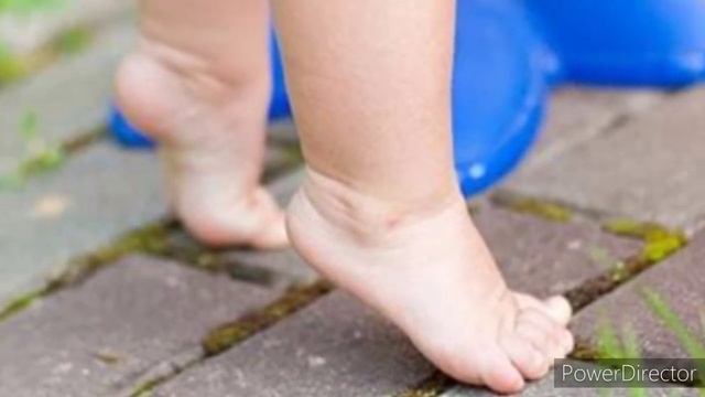 Лабиринтный тонический рефлекс. Нарушение осанки, координации, косоглазие. ДЦП смотреть онлайн