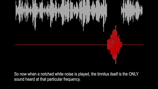 How Audio Notching Treats Tinnitus