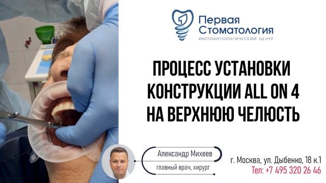 All on 4 процесс установки и результат. Installation process and result. смотреть онлайн