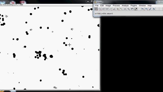 Counting Cells with ImageJ смотреть онлайн