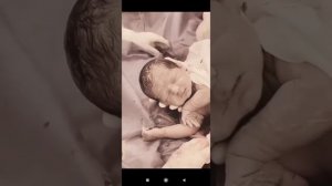 КЕСАРЕВО СЕЧЕНИЕ ВОТ ЭТО РАБОТА