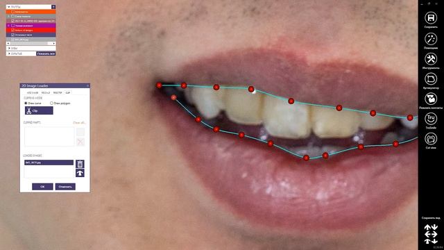 Работа с фотографией в Exocad смотреть онлайн