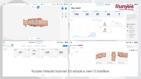 IOS V 3 - Ready to take your DIGITAL DENTISTRY journey to a whole new level?