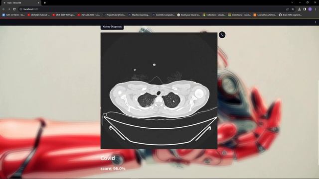MEDICAL IMAGE SEGMENTATION USING DEEP LEARNING ( UNET CNN ARCHITECHTURE ) || PBL PROJECT смотреть онлайн